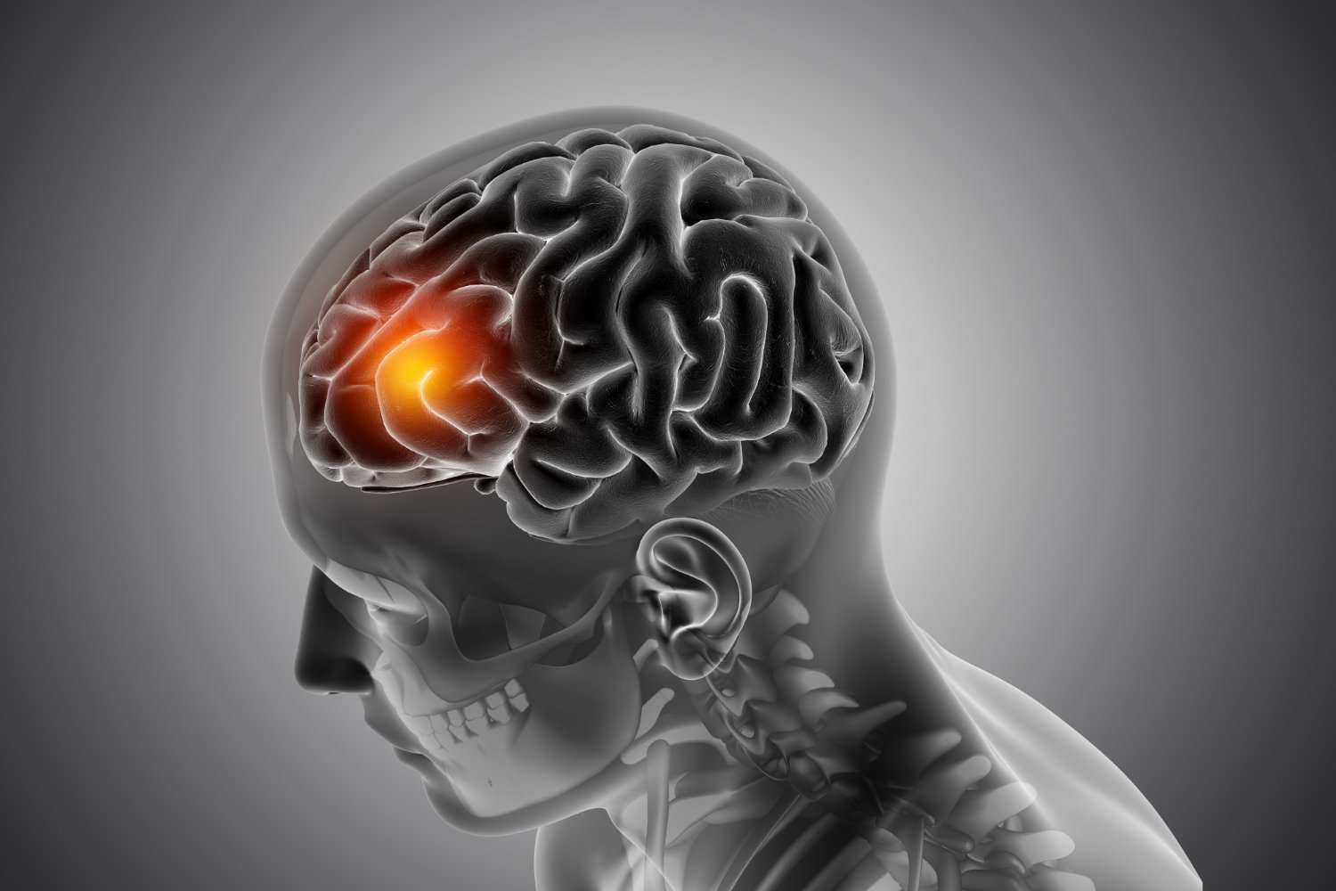 Epilepsy Diagnosis